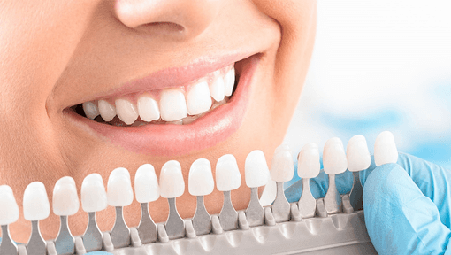 teeth whitening for crowned teeth