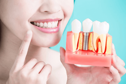 what is the process for tooth implants