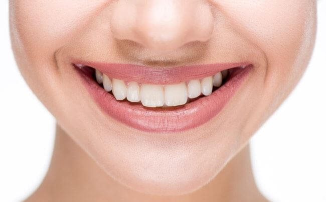 How Dental Veneers Can Help Overcome Numerous Dental Flaws