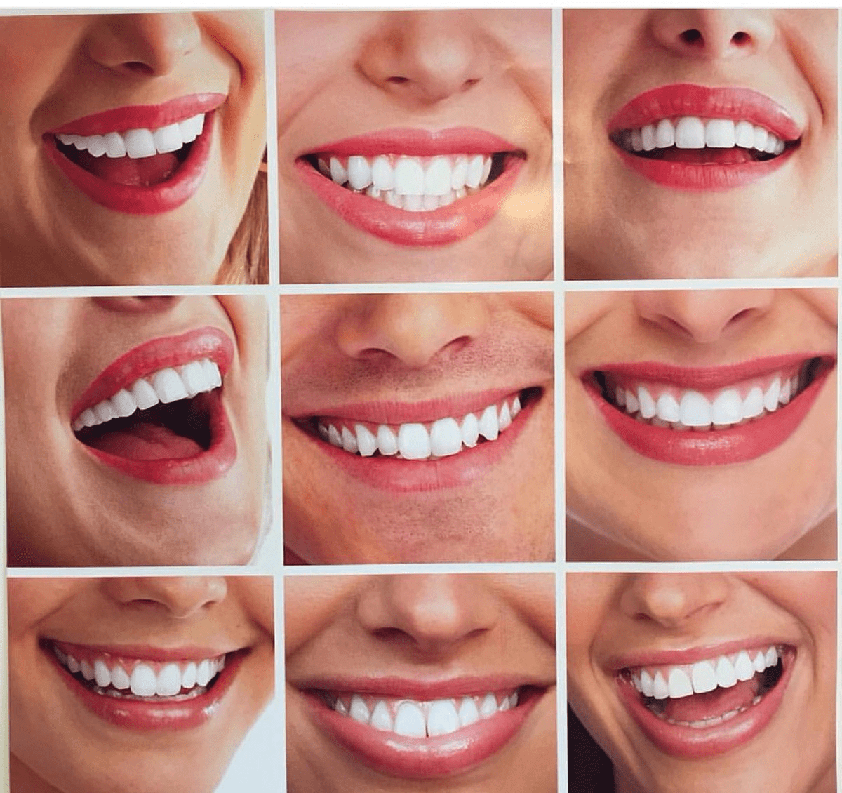 Как улыбаться с зубами. Красивые зубы. Красивые ровные зубы. Красивые белоснежные зубы. Красивые ровные белые зубы.